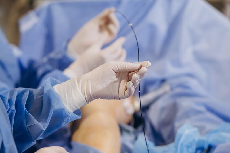 angioplastia é um procedimento comprovado que salvou muitas vidas